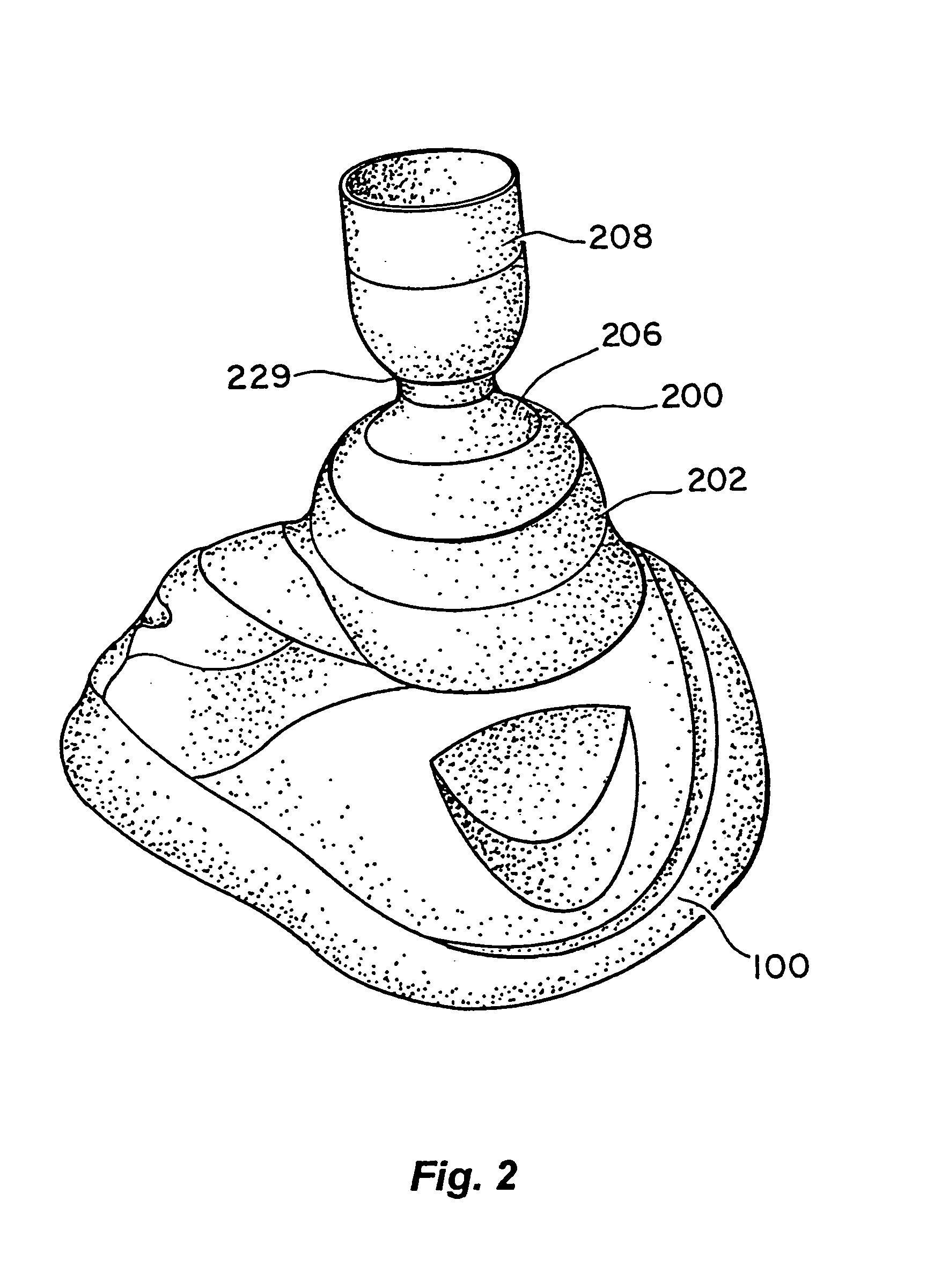 Systems and methods for increasing cerebral spinal fluid flow