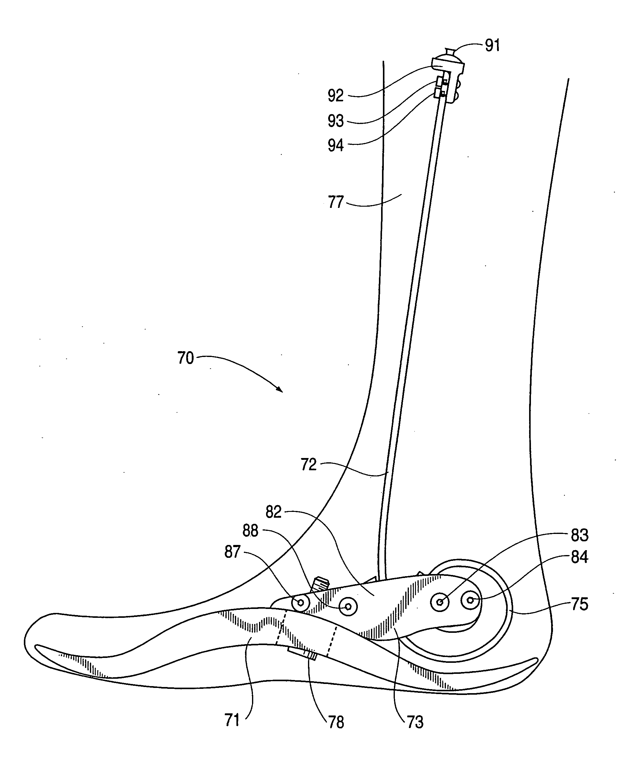 Prosthetic Foot with Tunable Performance
