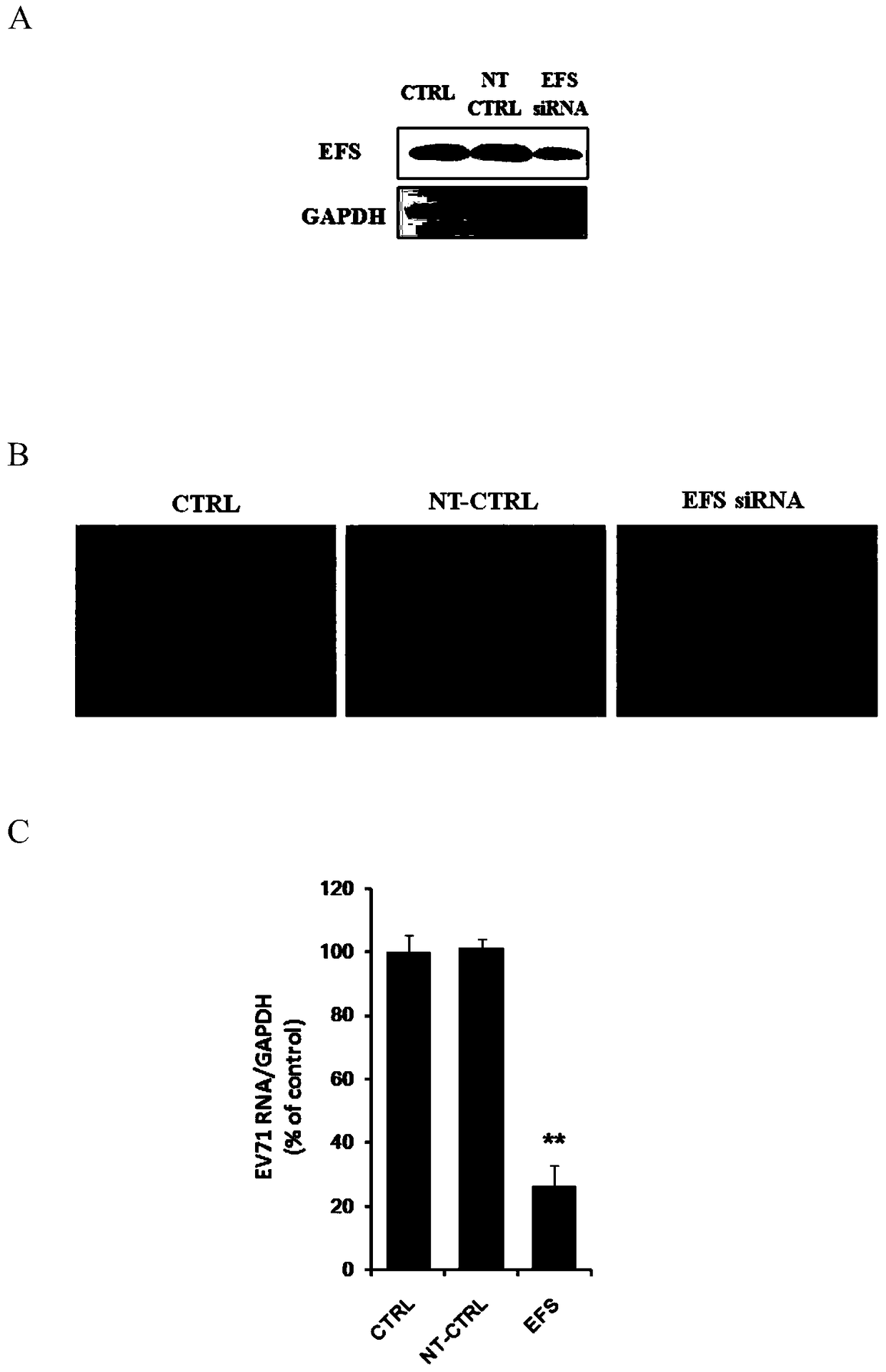 Application of protein tyrosine kinase fyn oncogene in prevention and treatment of enterovirus 71 infection