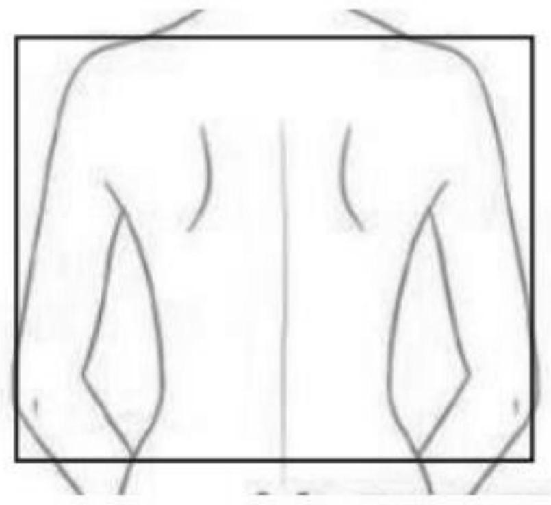 Systems and methods for scoliosis probability assessment