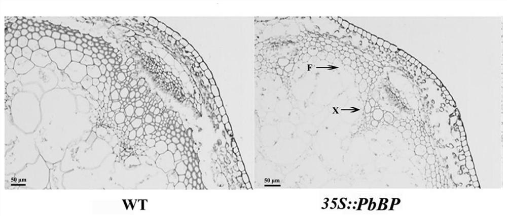 A kind of pear transcription factor pbbp and its application