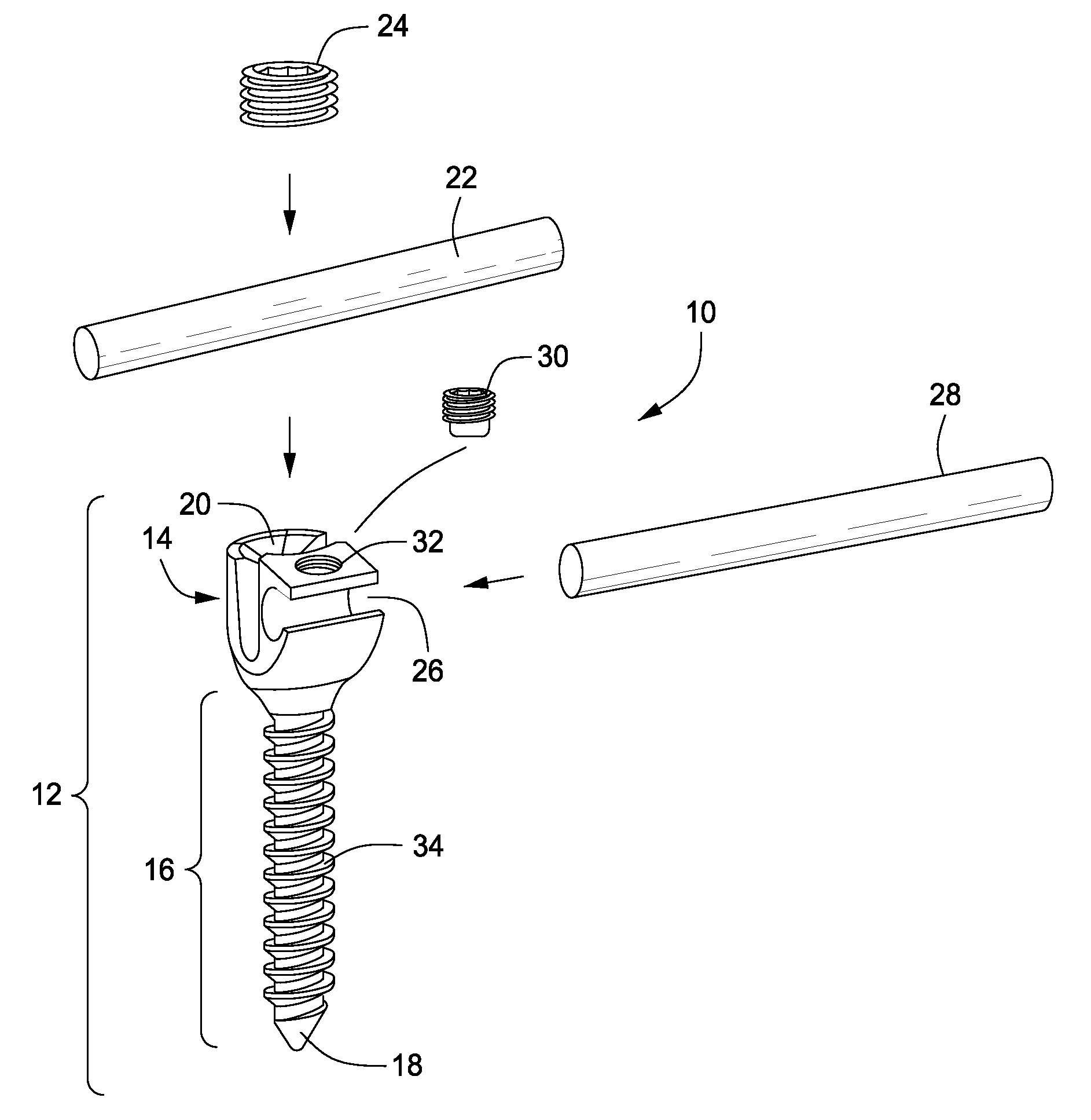 Orthopedic Fastener for Stabilization and Fixation
