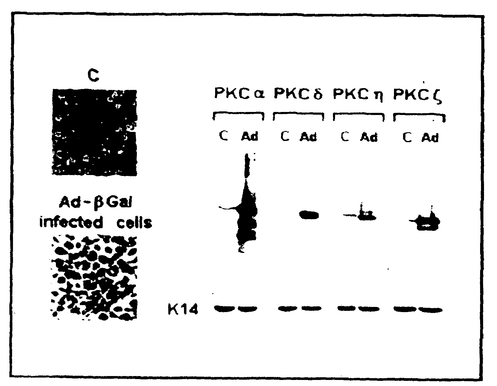 Methods and pharmaceutical compositions for healing wounds