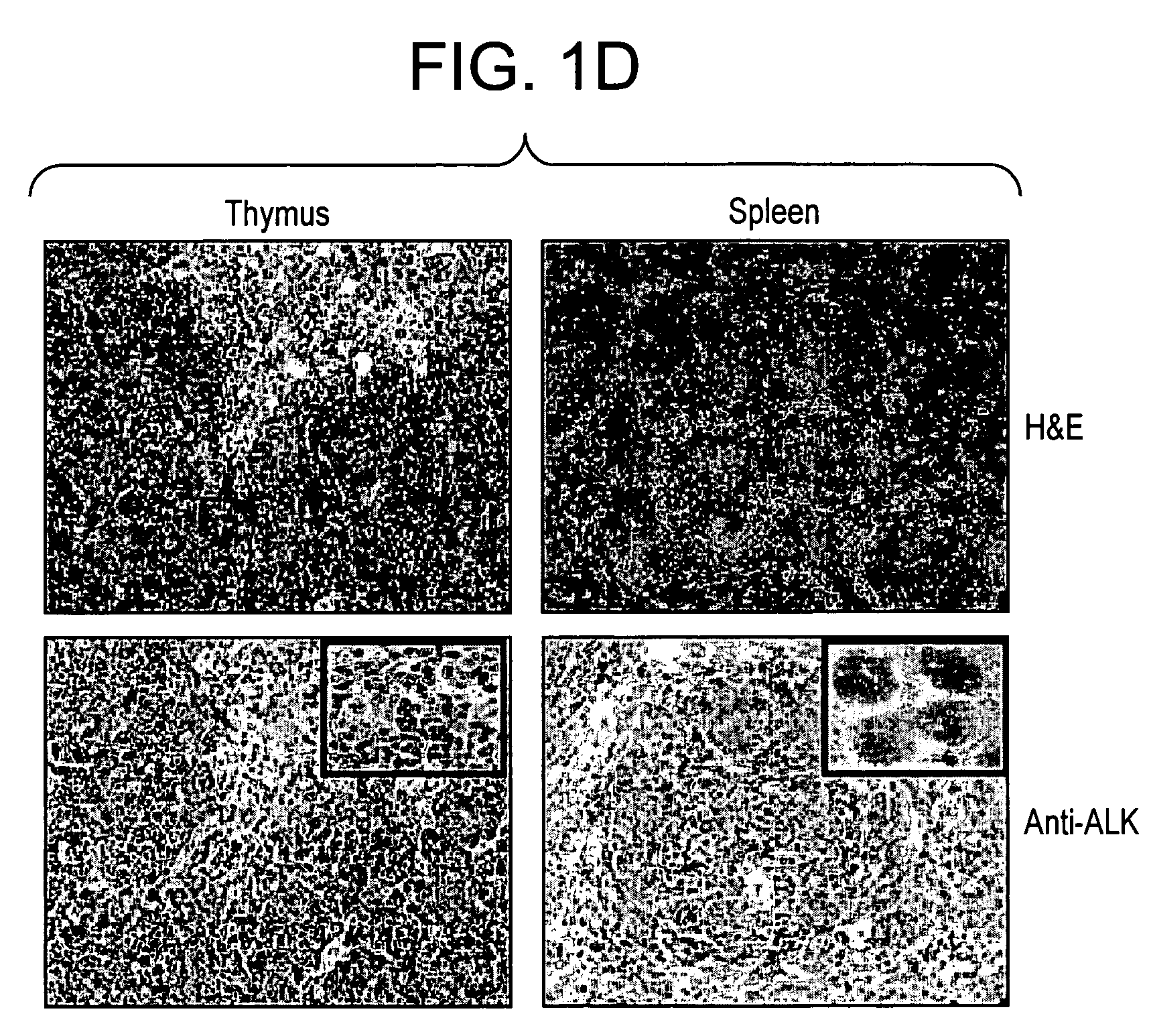 ALK protein tyrosine kinase, cells and methods embodying and using same