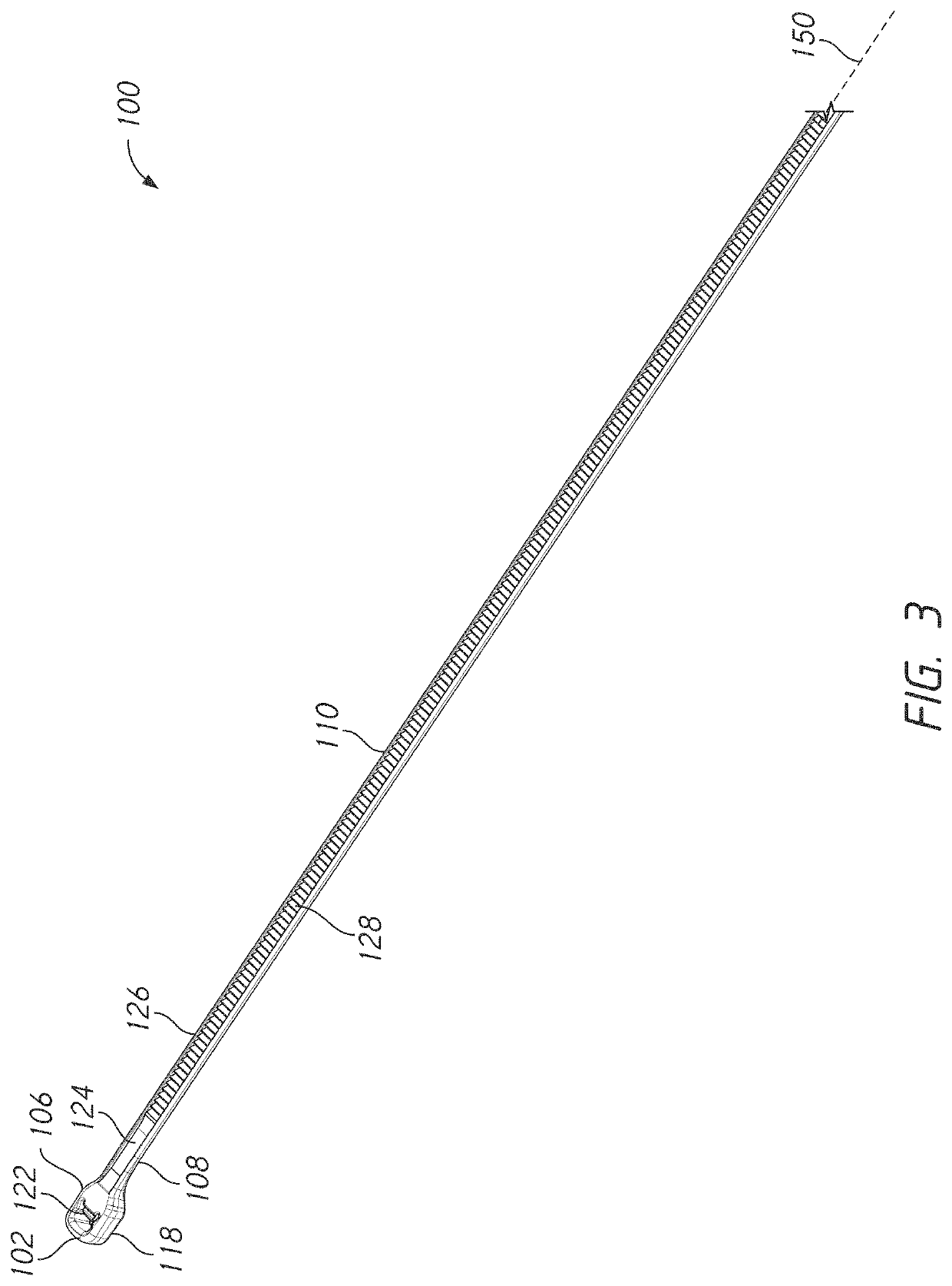 Bone tie and bone tie inserter