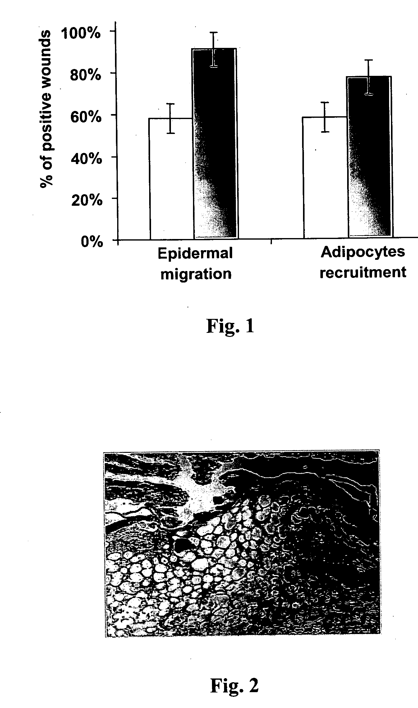 Methods for accelerating wound healing by administration of adipokines