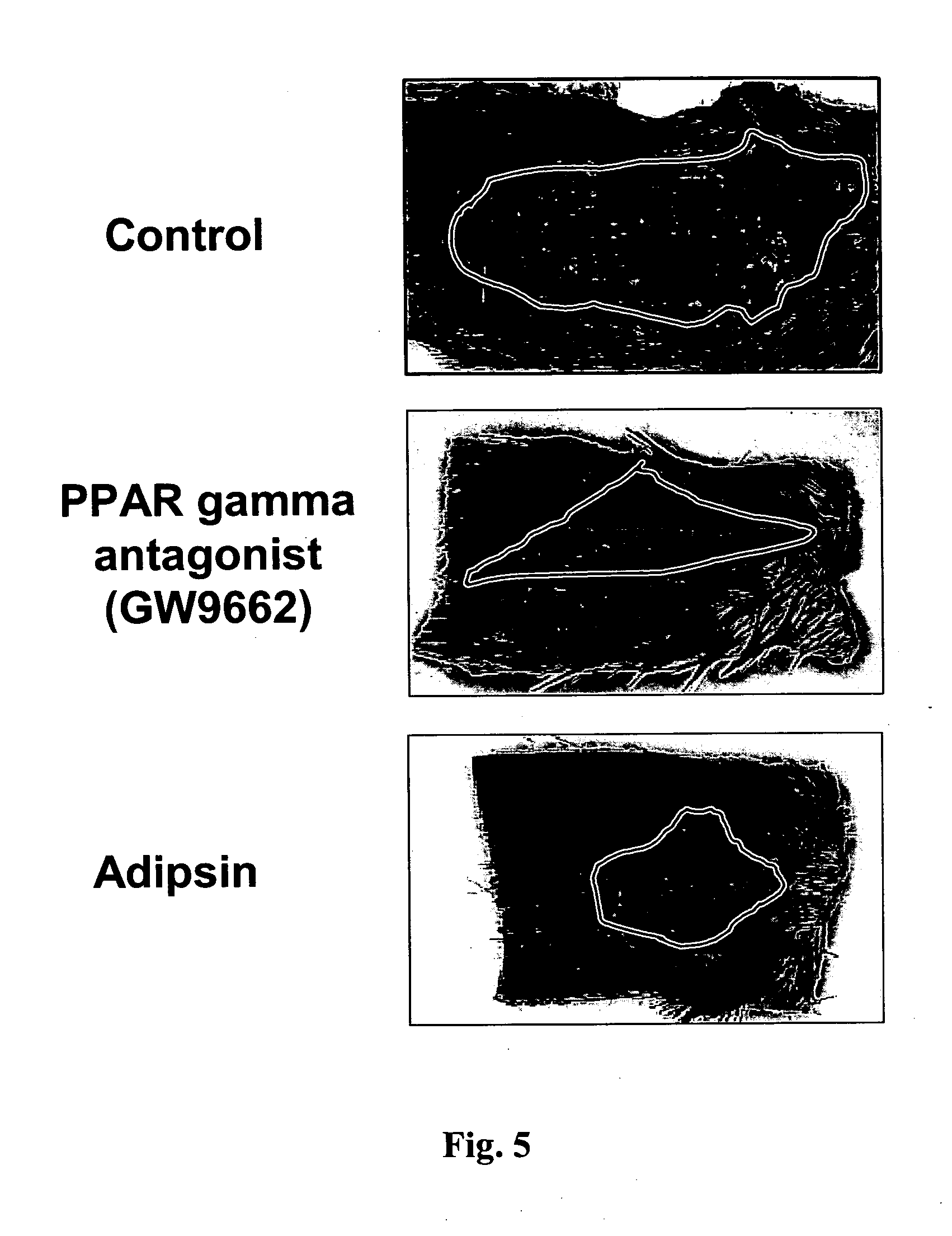 Methods for accelerating wound healing by administration of adipokines