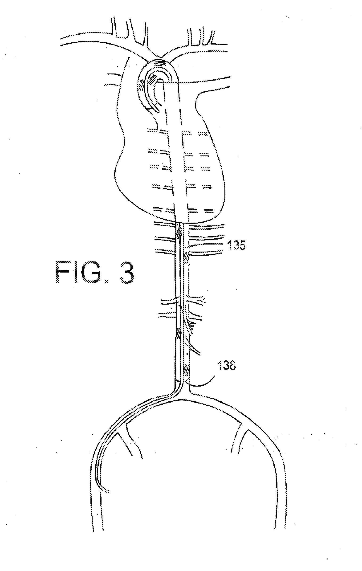 Methods, compositions and apparatus for delivering heterologous molecules to cells