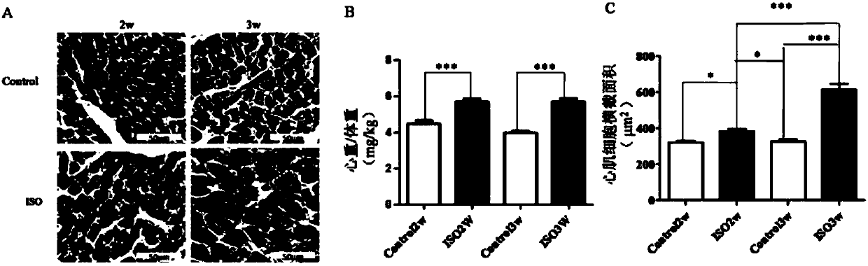 Polypeptide drug Athycaltide and application thereof