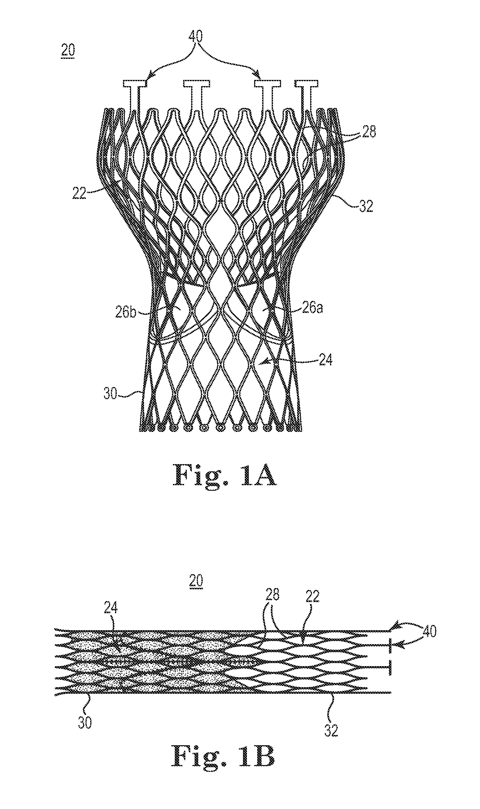 Transcatheter Prosthetic Heart Valve Delivery Device With Passive Trigger Release