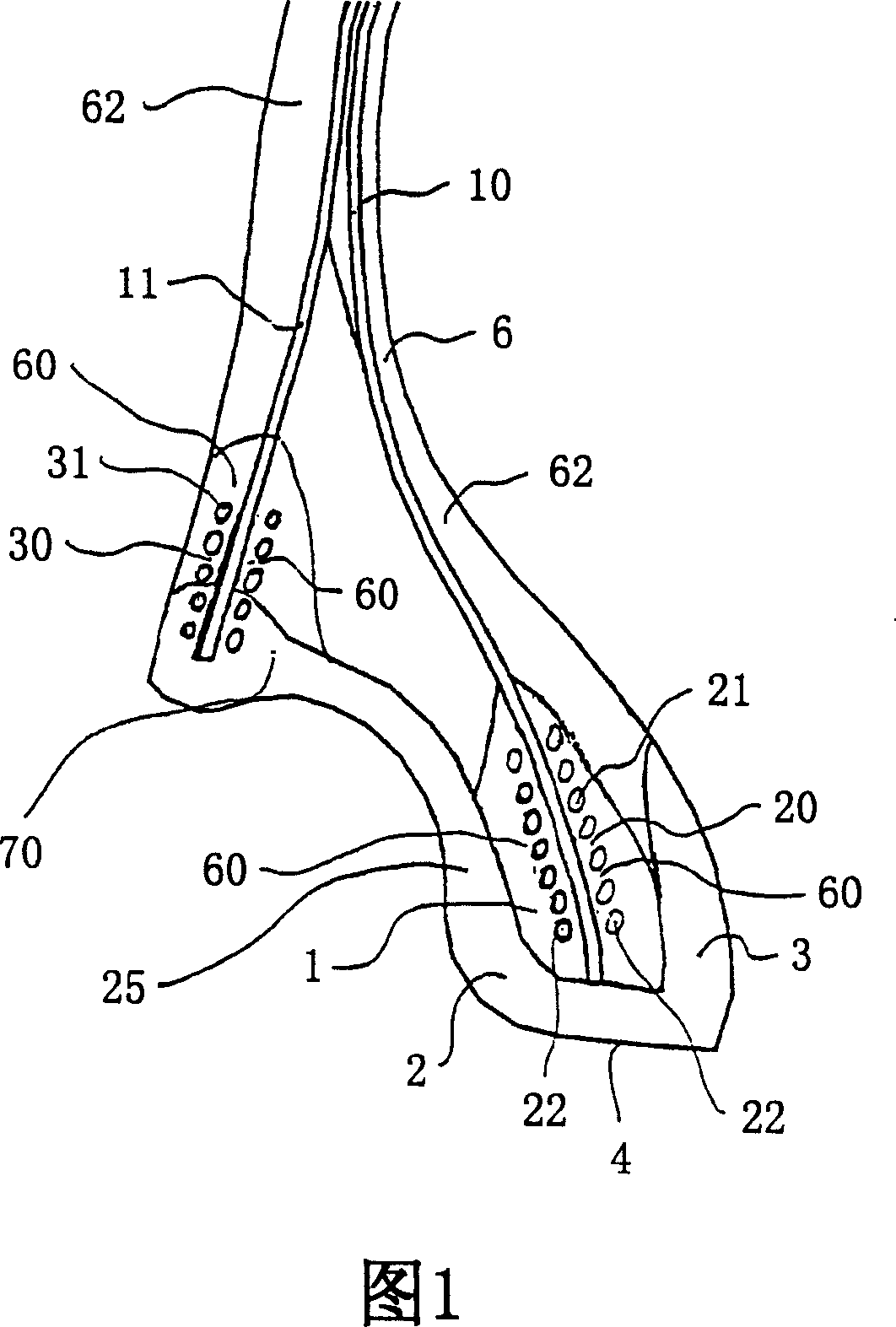 Tyre with double-anchoring casing ply