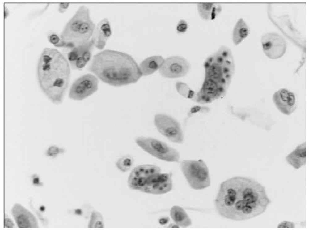 Multi-staining flaking method of cytopathology sample