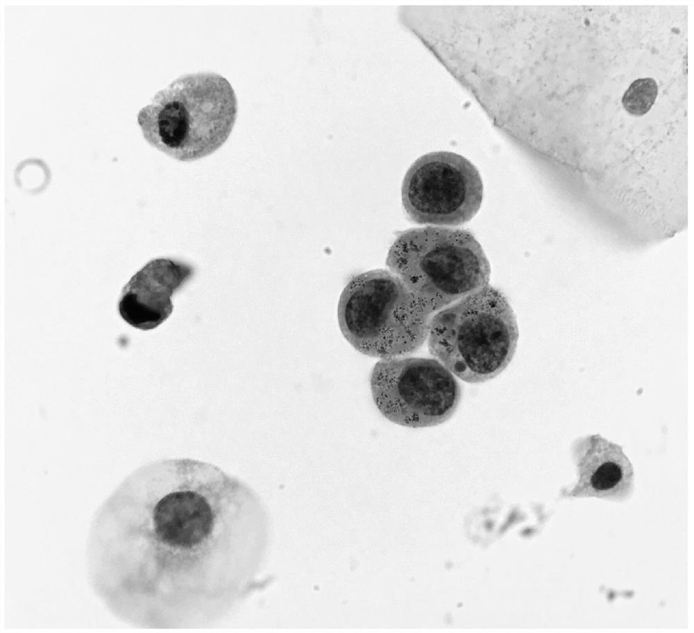 Multi-staining flaking method of cytopathology sample