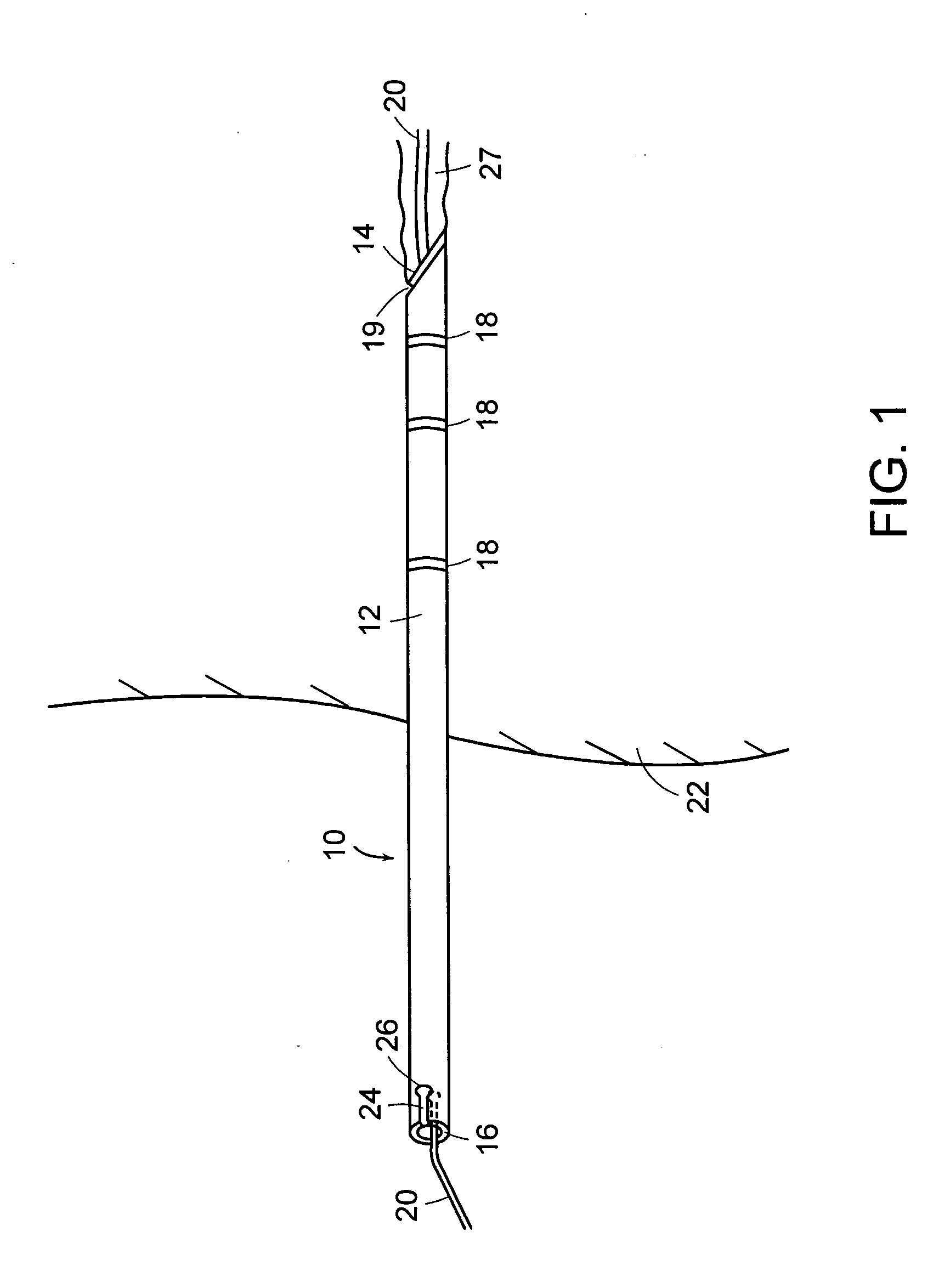 Apparatus and method for establishing access to the body