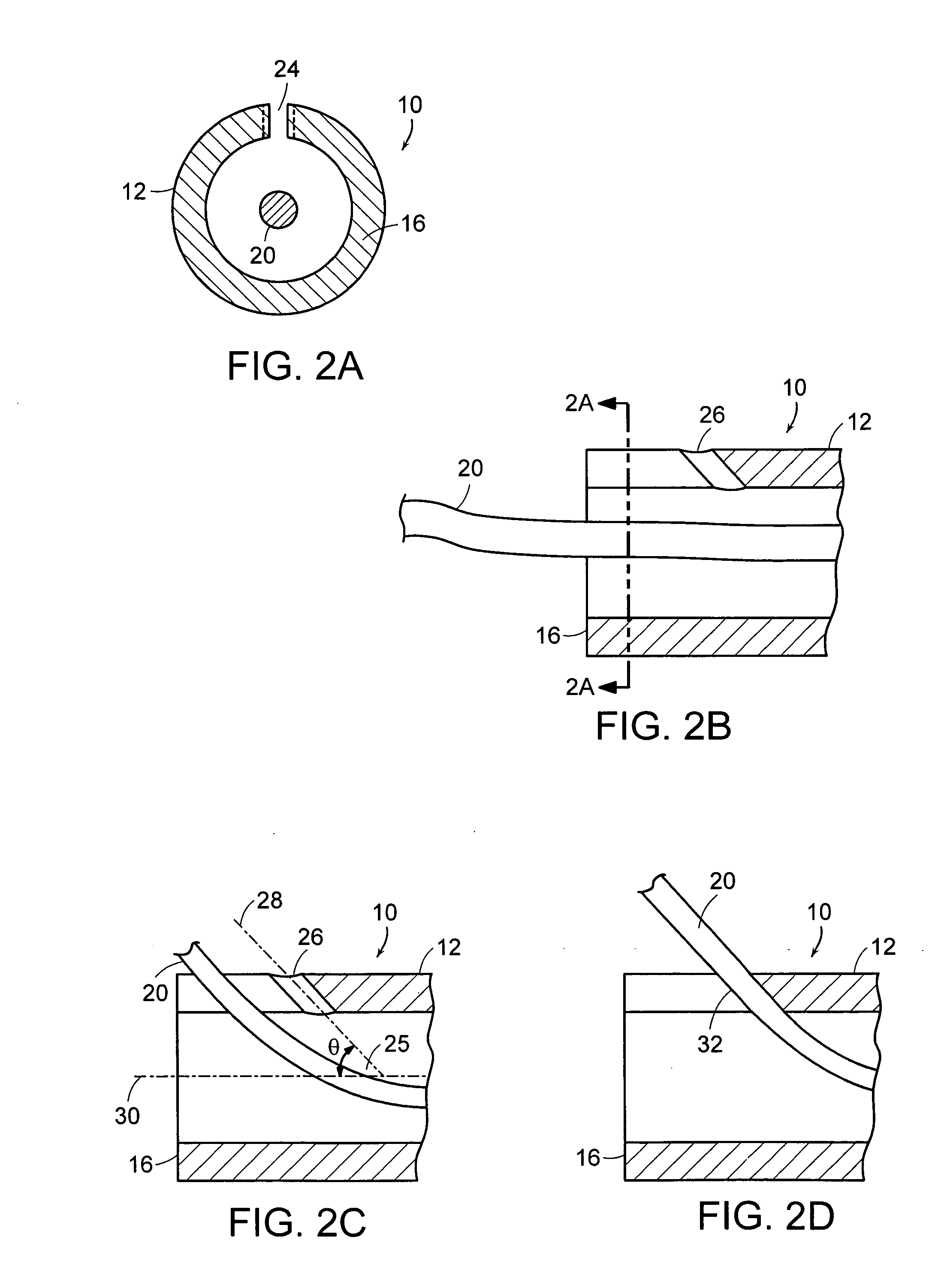 Apparatus and method for establishing access to the body