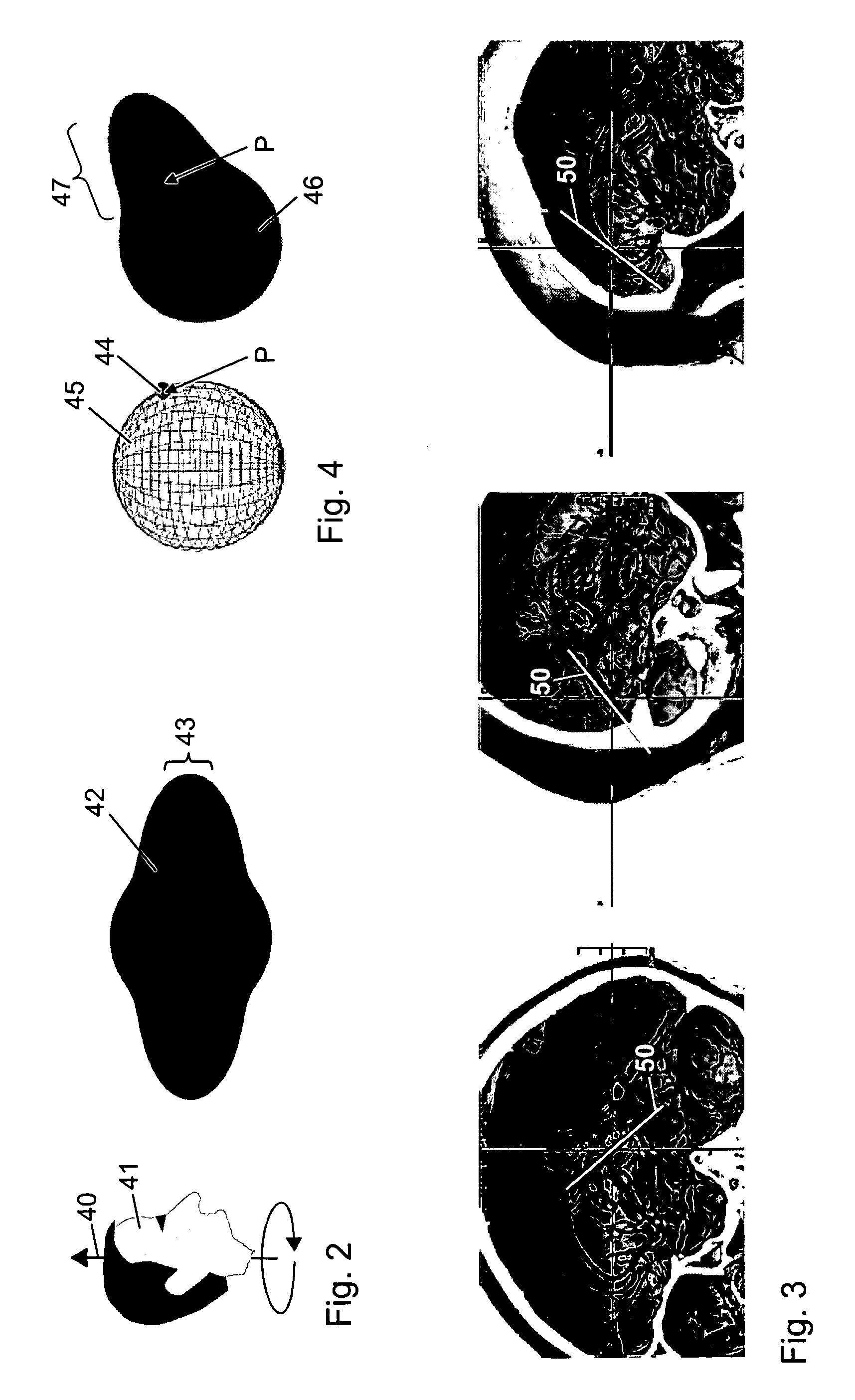 Method and Apparatus for Volume Rendering of Medical Data Sets