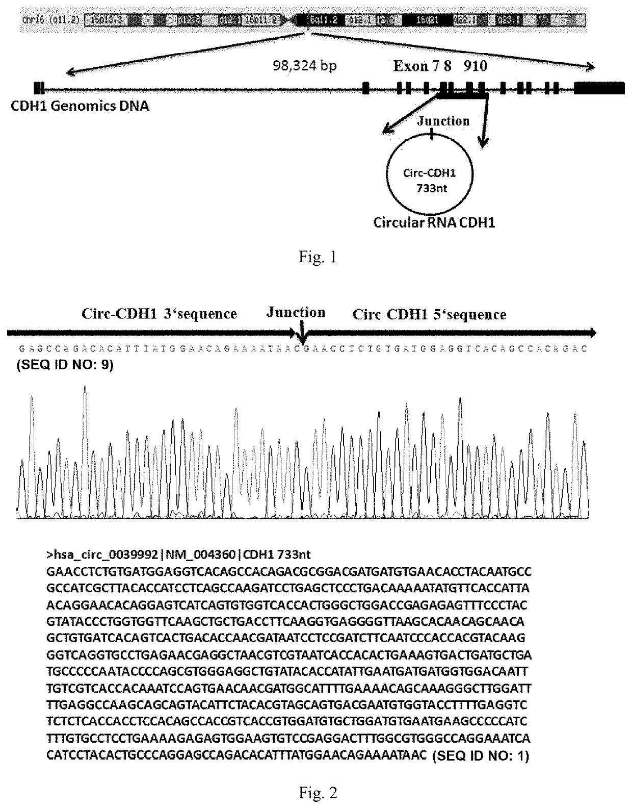 Use of Circ-CDH1 Inhibitors
