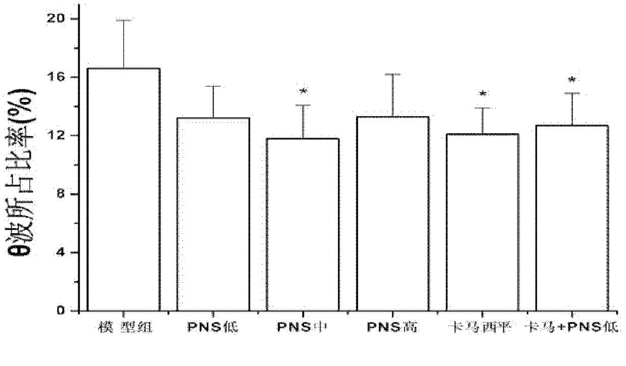 Antiepileptic drug, preparation method and application thereof