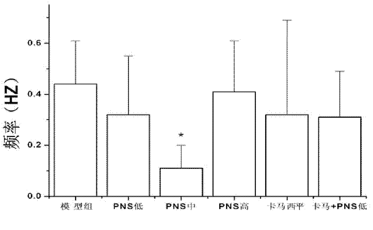 Antiepileptic drug, preparation method and application thereof