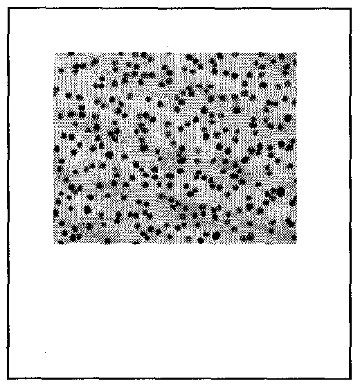 Compositions and methods for the prevention and treatment of cancer