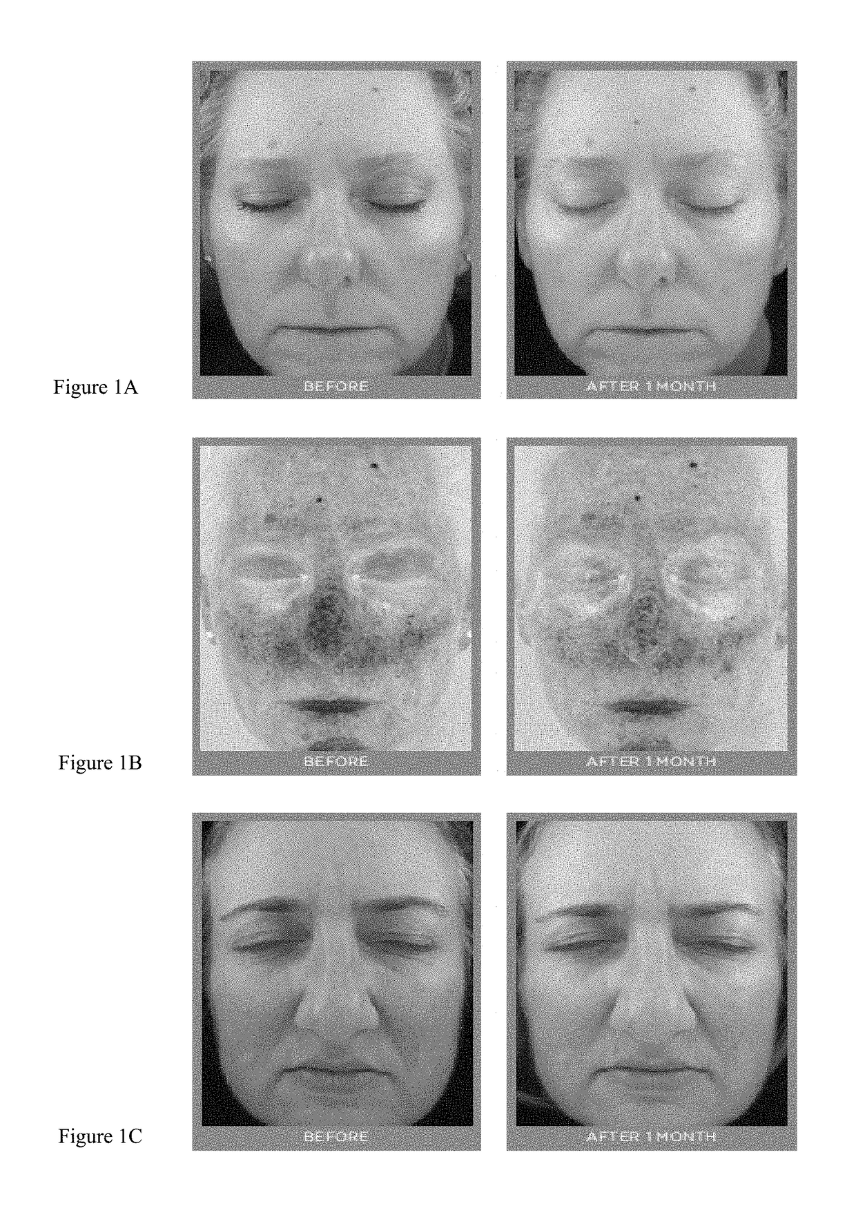 Cosmetic formulation to reduce facial flushing