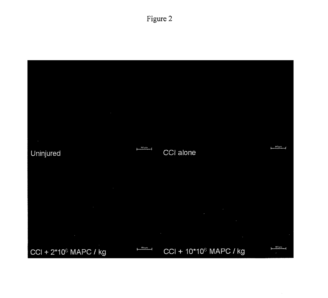 Modulation of splenocytes in cell therapy