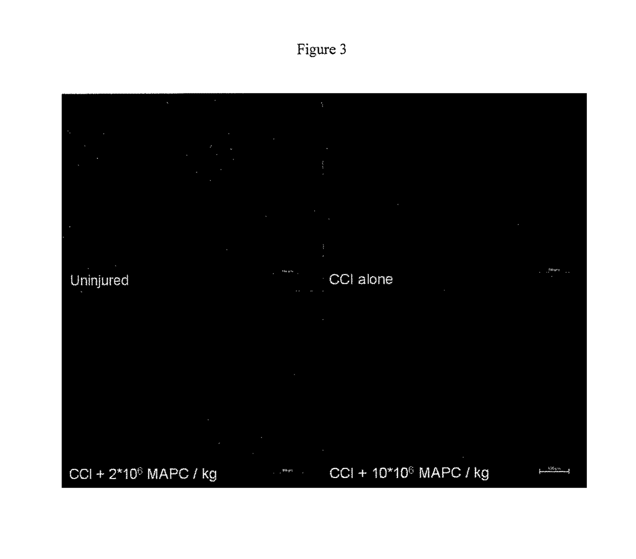 Modulation of splenocytes in cell therapy