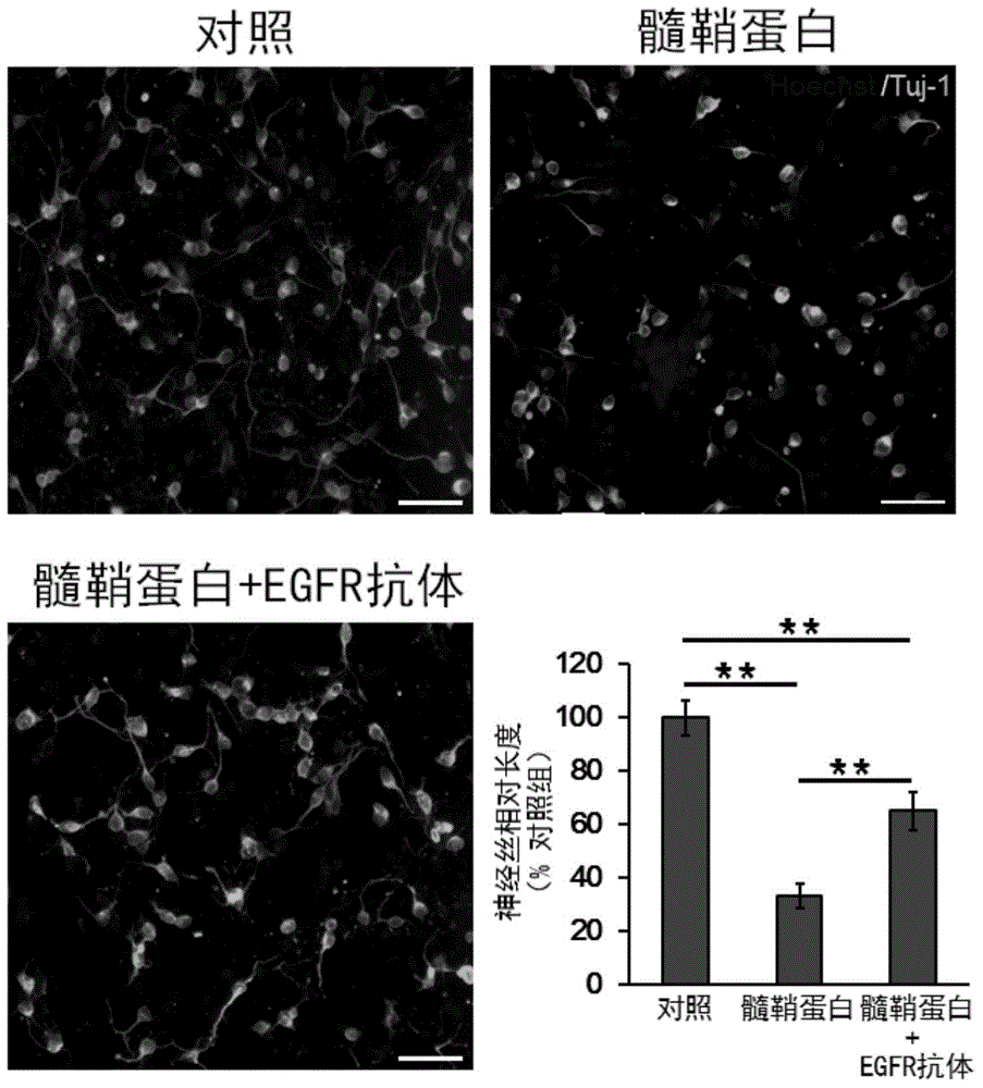 Application of cetuximab and collagen scaffold loaded with cetuximab to preparation of drug for repairing spinal cord injury