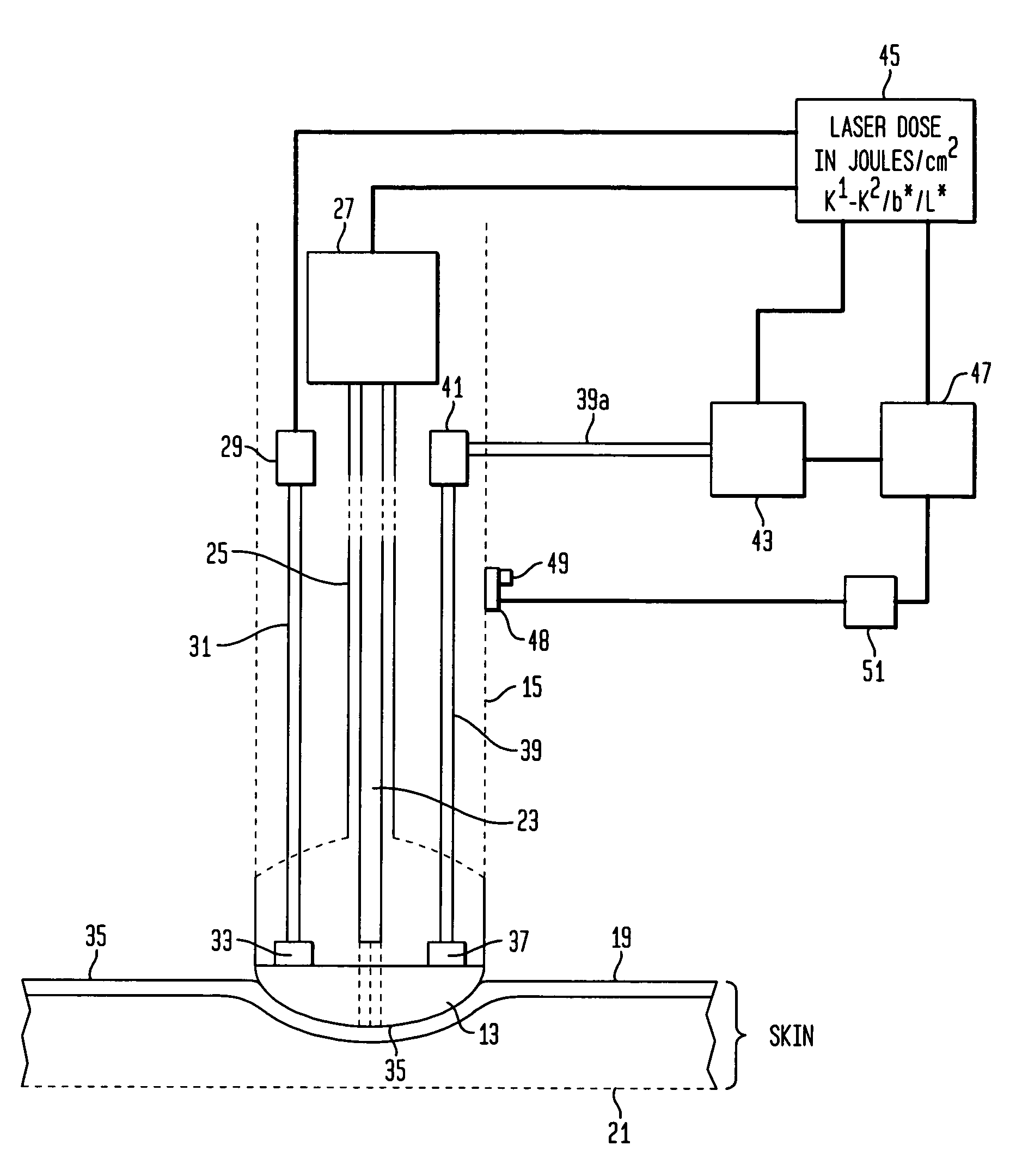 Method and apparatus for laser removal of hair