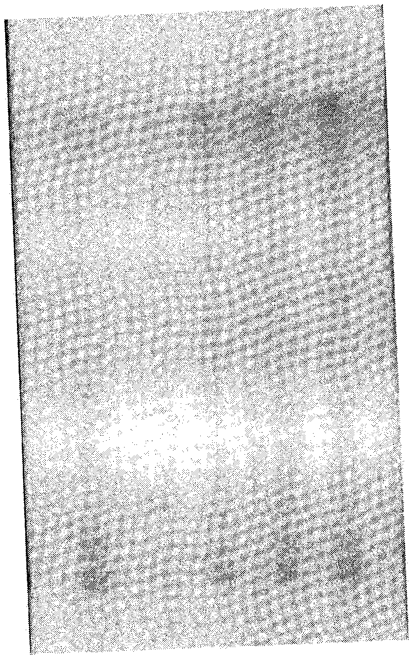 Clarification technology and quality control method of medicinal composition having acne treatment effect