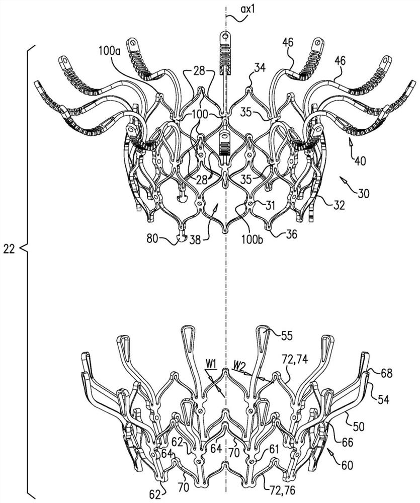 Prosthetic heart valve with pouch