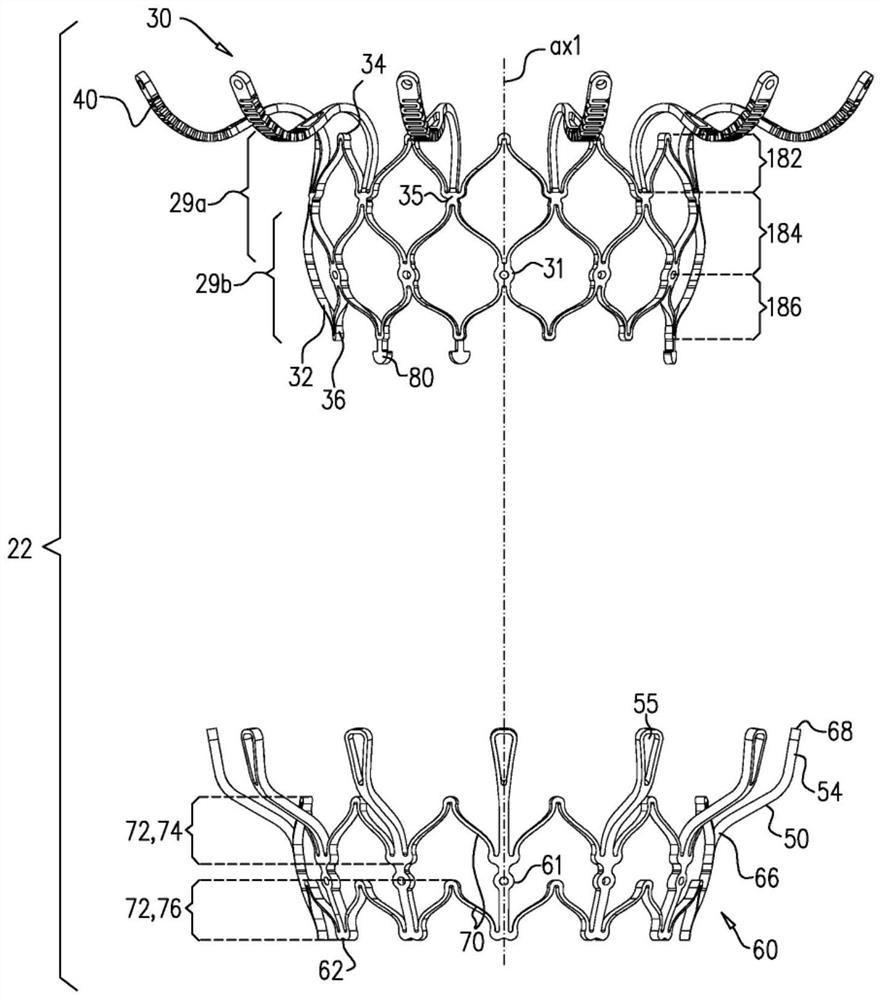 Prosthetic heart valve with pouch