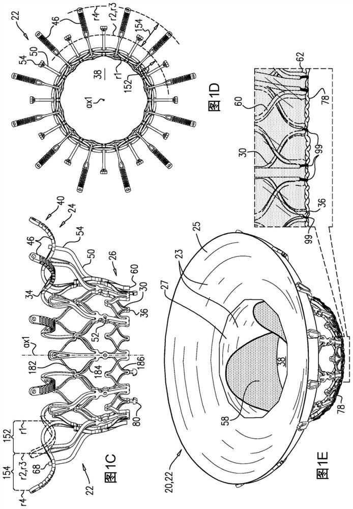 Prosthetic heart valve with pouch