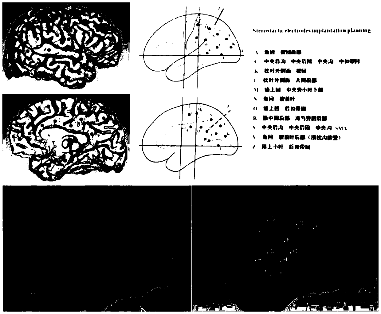 Method for manufacturing electrode gyrus scale map