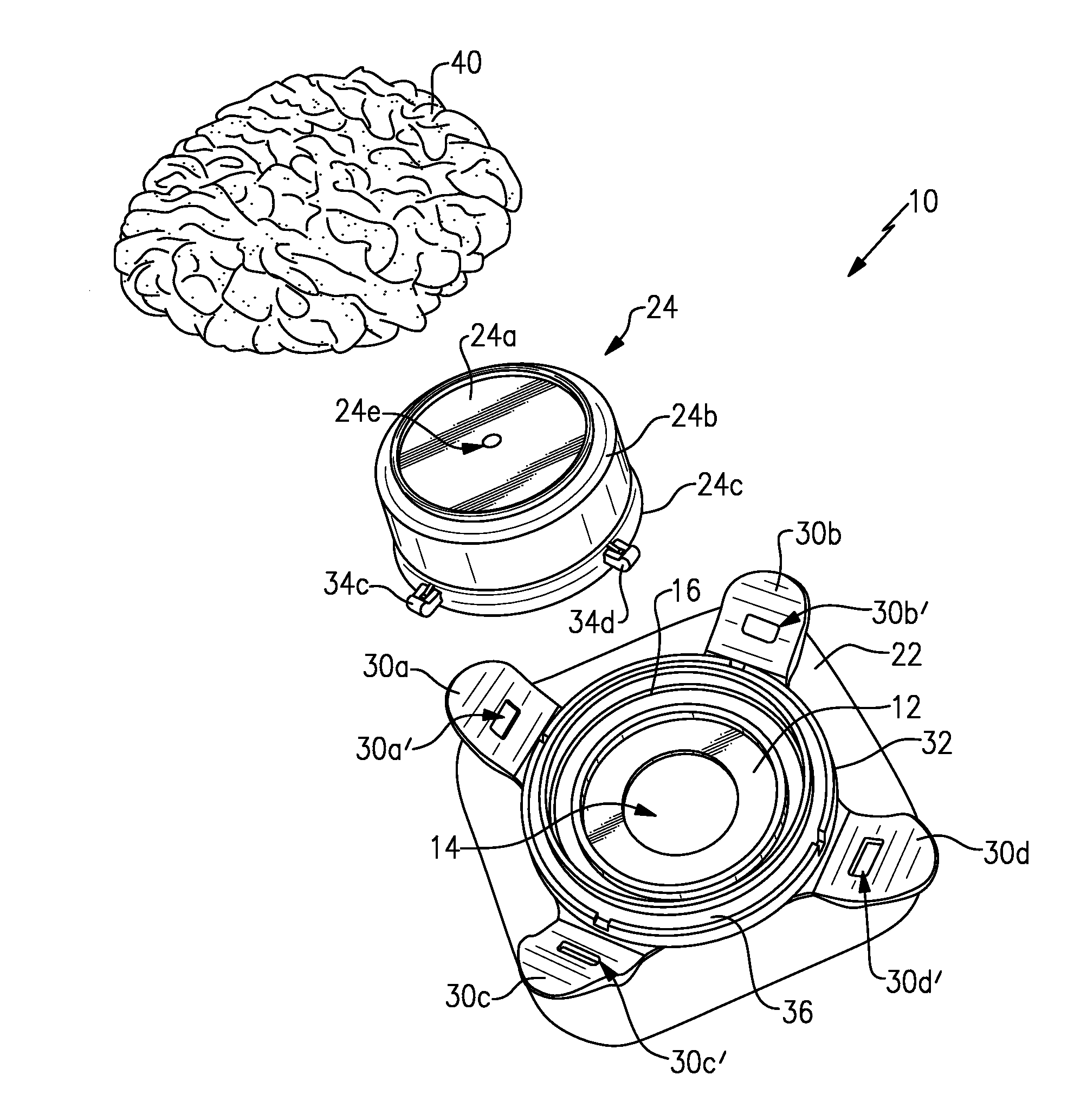 Ostomy appliance and method