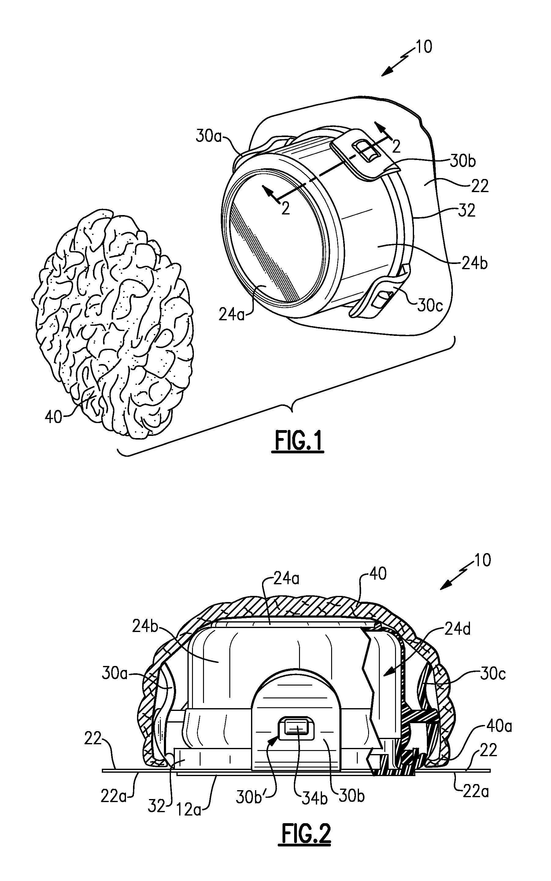 Ostomy appliance and method