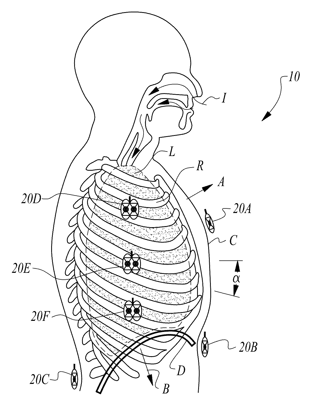 Apparatus and method for continuous noninvasive measurement of respiratory function and events