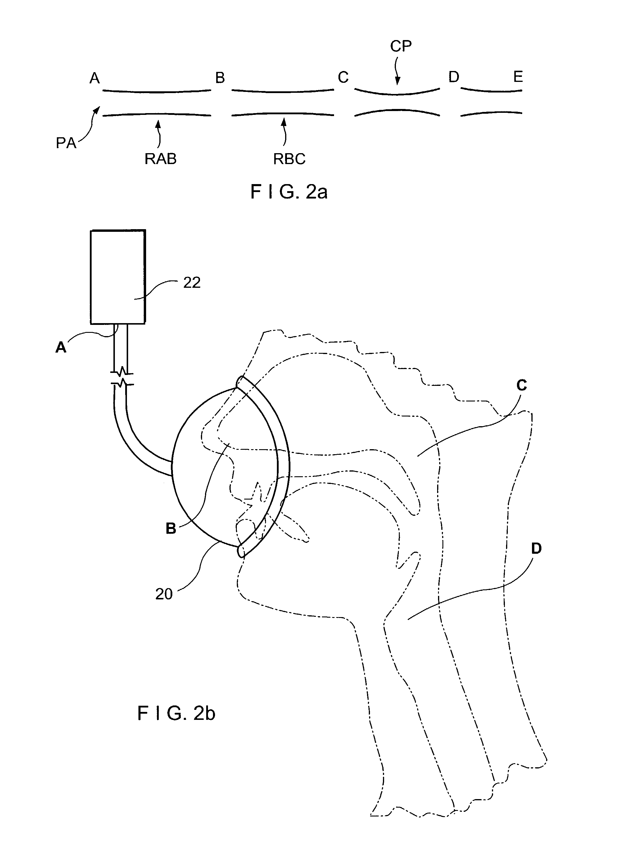 System and method for improved treatment of sleeping disorders using therapeutic positive airway pressure