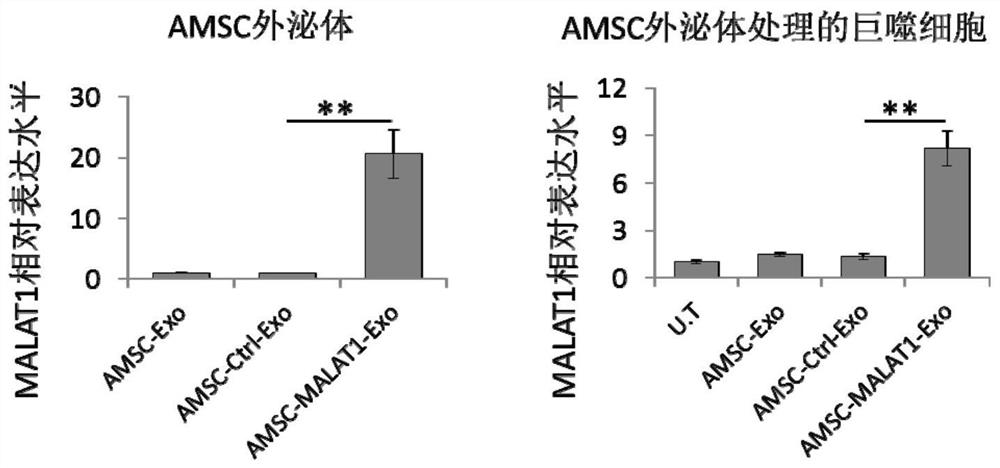 Application of amsc-malat1-exo in the preparation of medicines for treating liver diseases and its preparation method