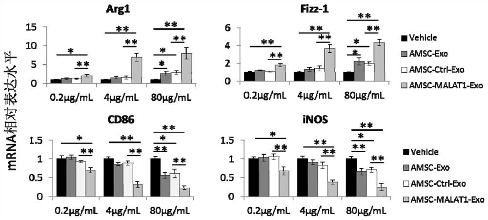 Application of amsc-malat1-exo in the preparation of medicines for treating liver diseases and its preparation method