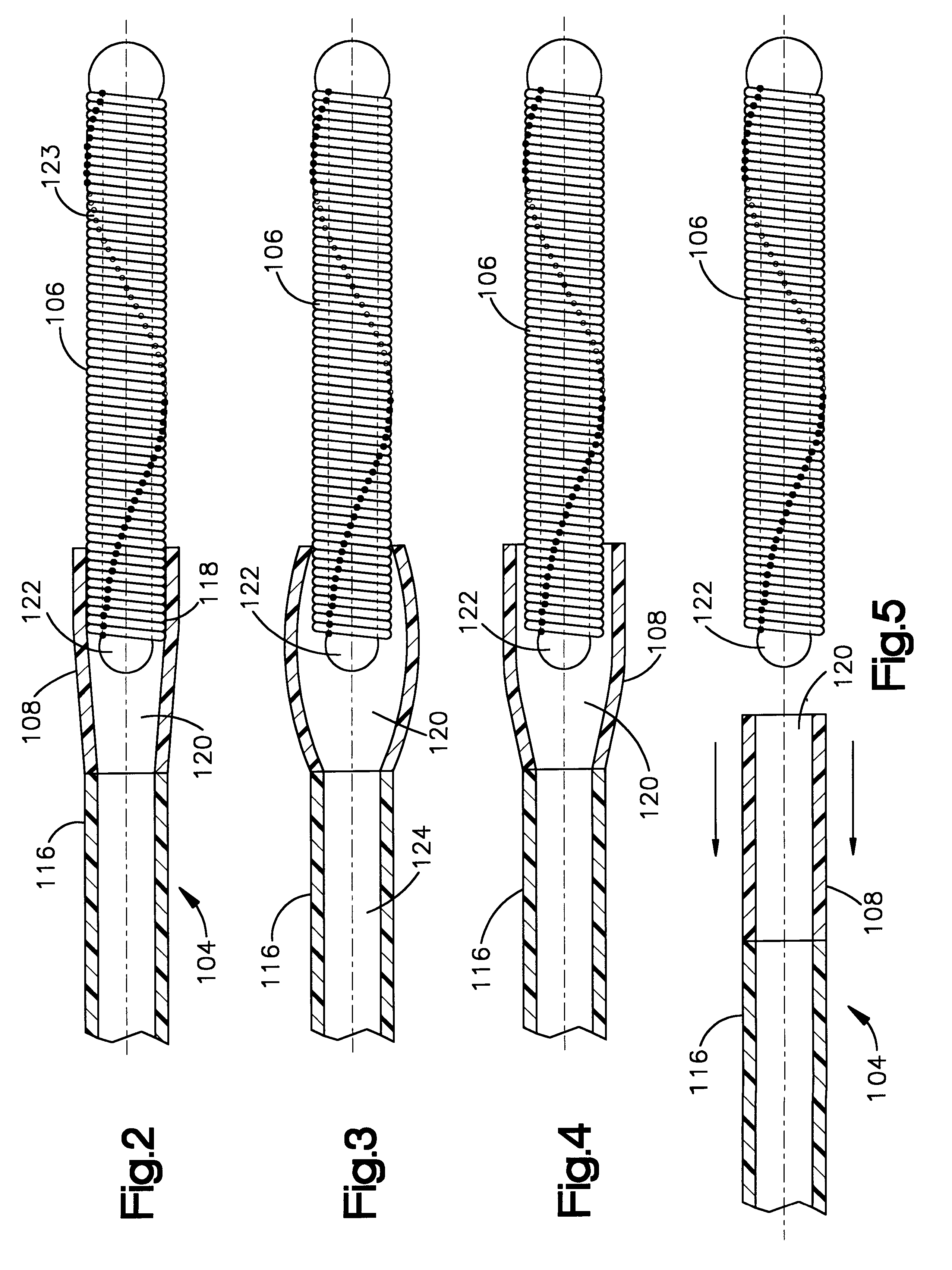 Stretch resistant embolic coil with variable stiffness