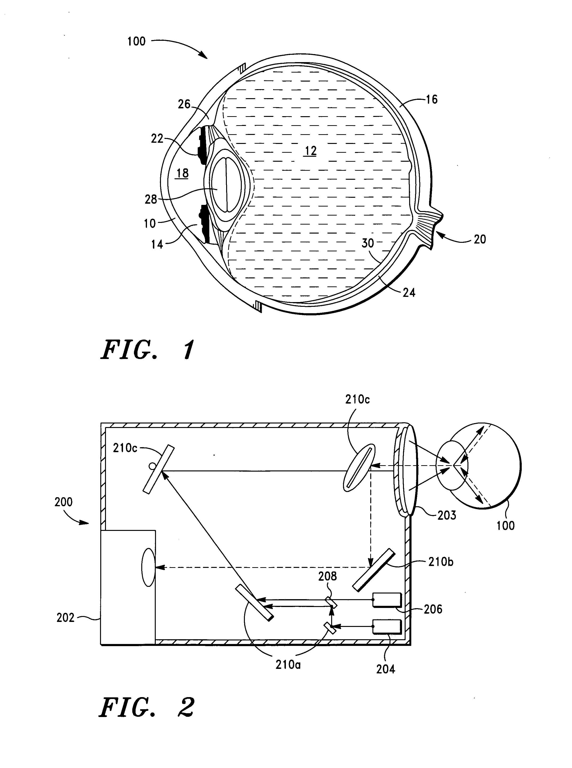 Laser coagulation of an eye structure from a remote location