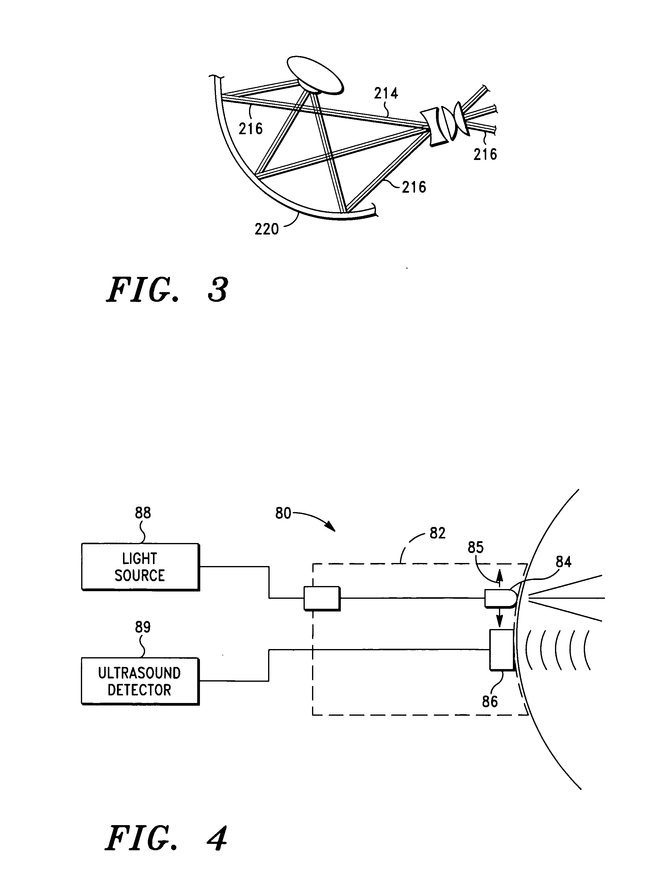 Laser coagulation of an eye structure from a remote location