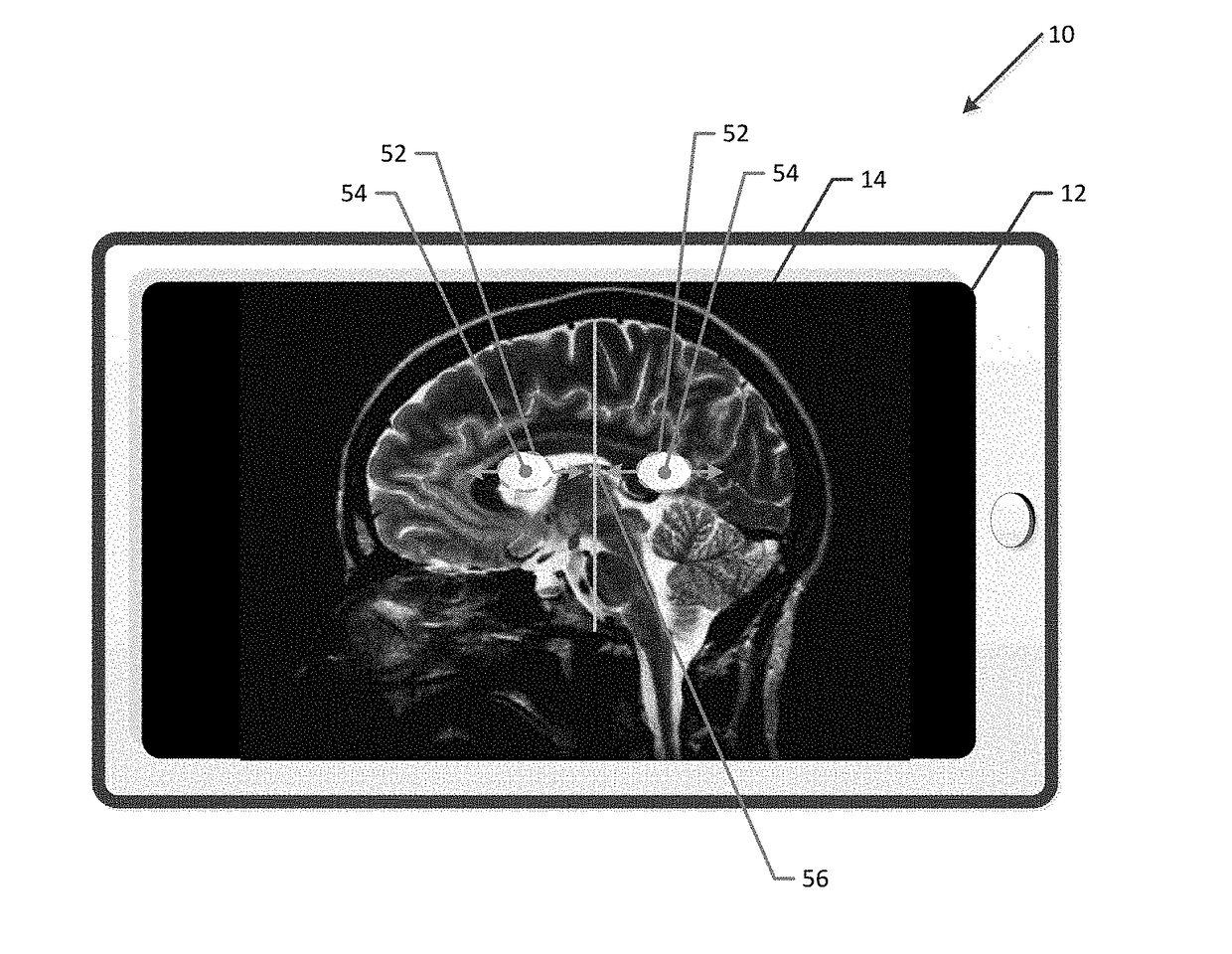 Method and computing device for window width and window level adjustment utilizing a multitouch user interface