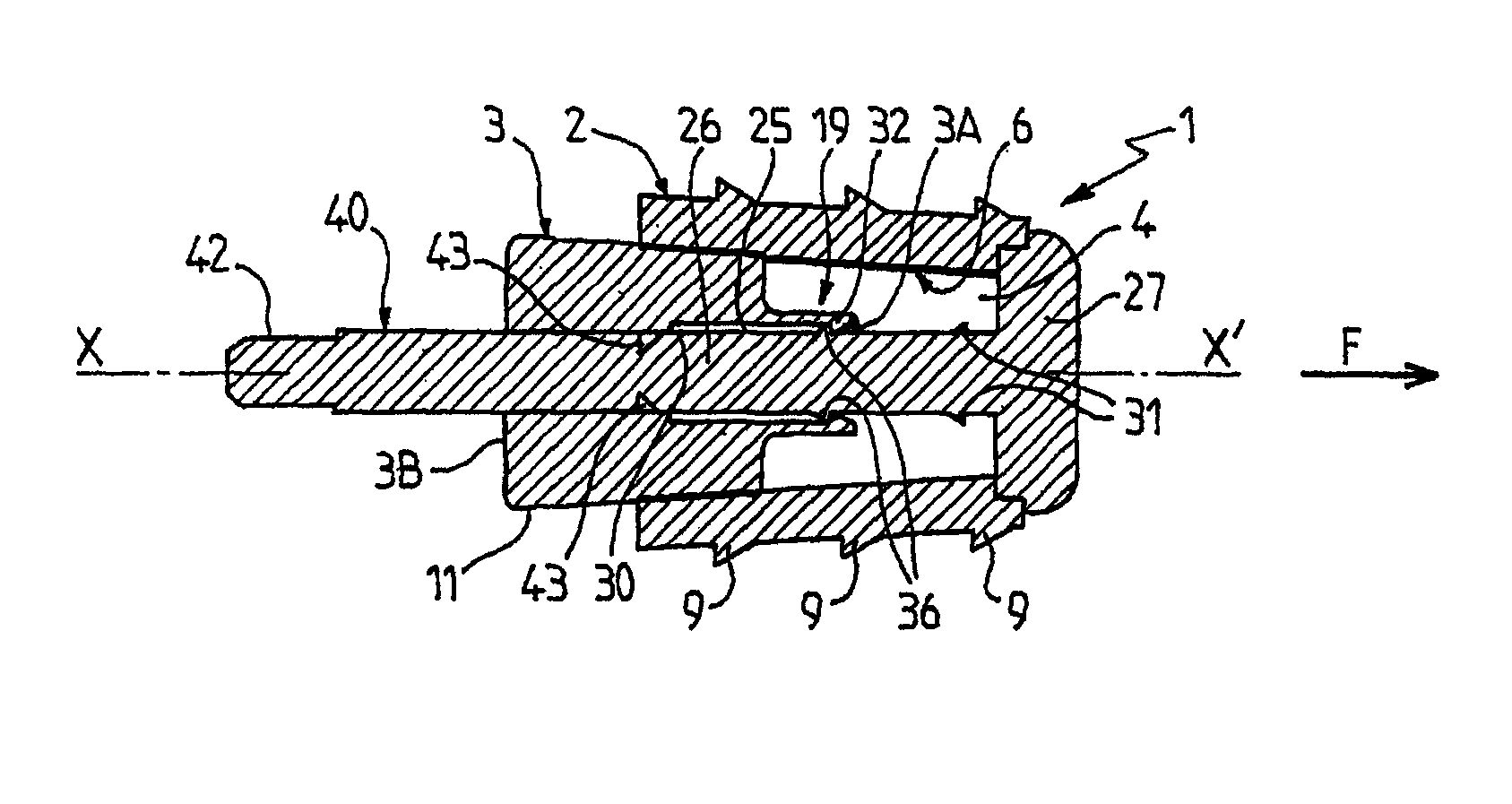 Surgical device for treating flat feet, and a corresponding surgical kit