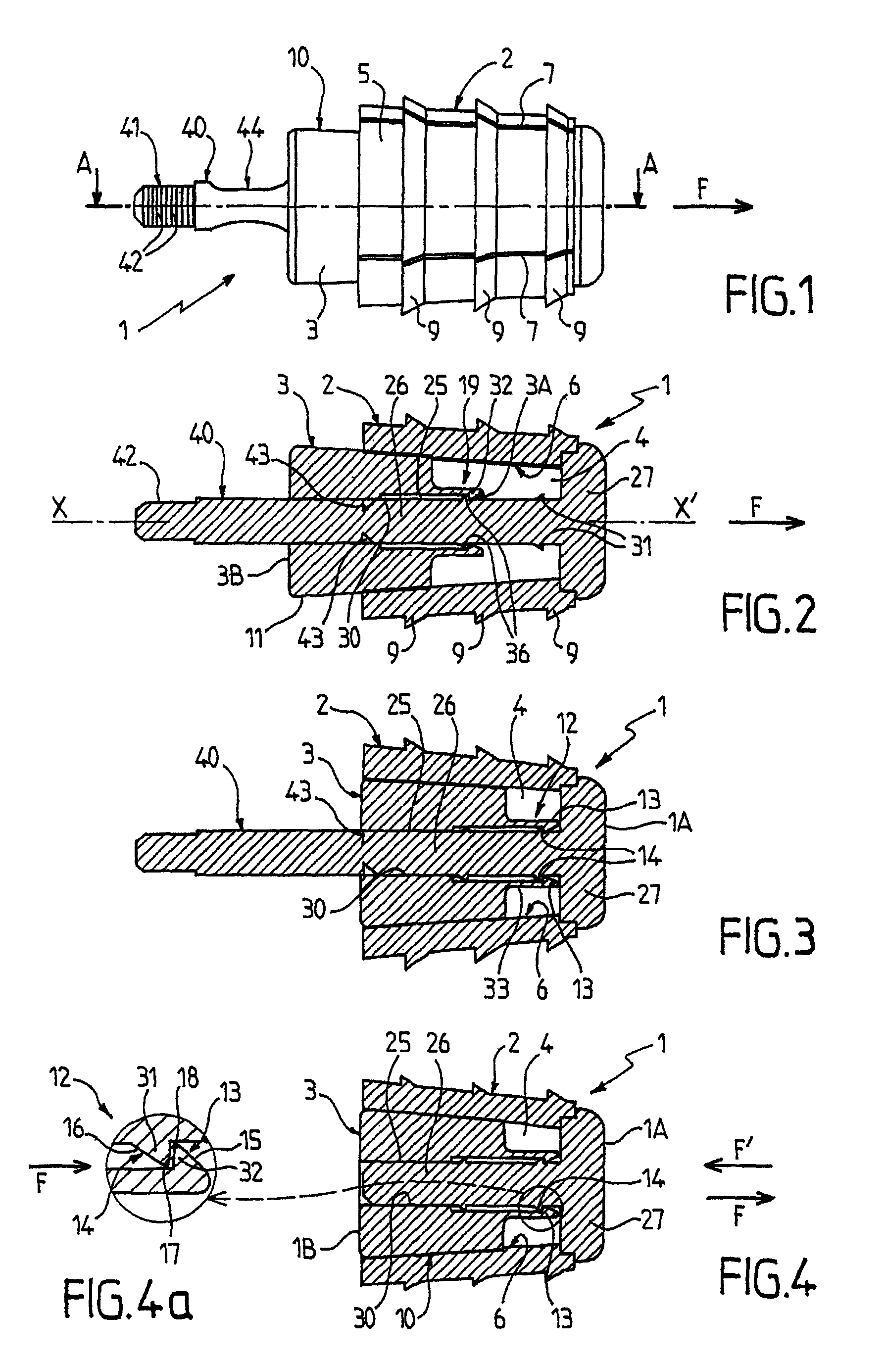 Surgical device for treating flat feet, and a corresponding surgical kit