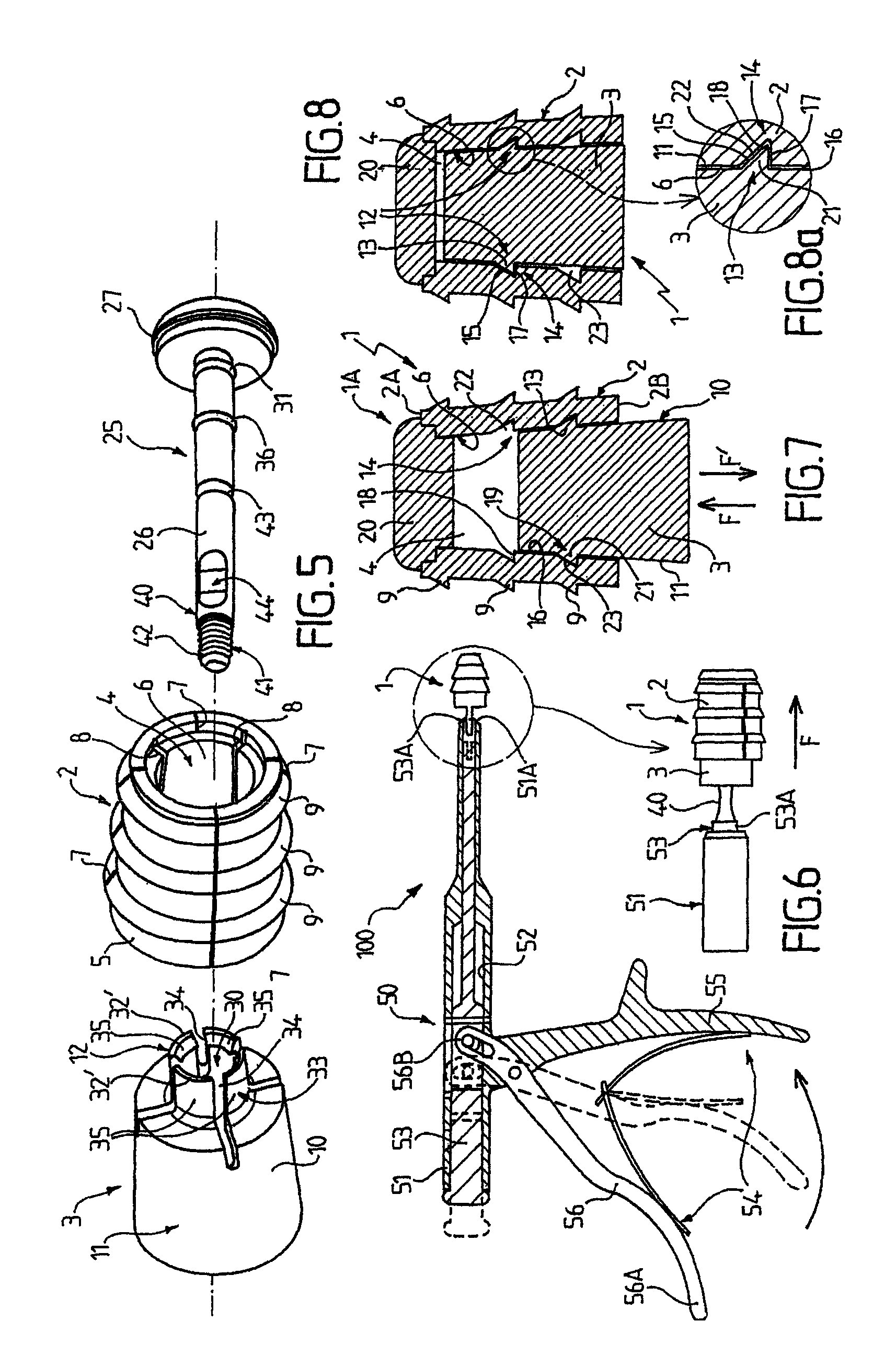 Surgical device for treating flat feet, and a corresponding surgical kit