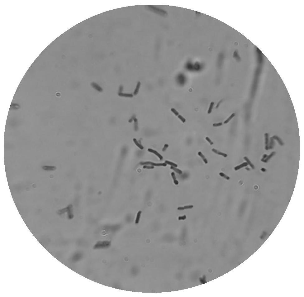 Clostridium butyricum and application of clostridium butyricum in immobilized fermentation production of 1, 3-propylene glycol
