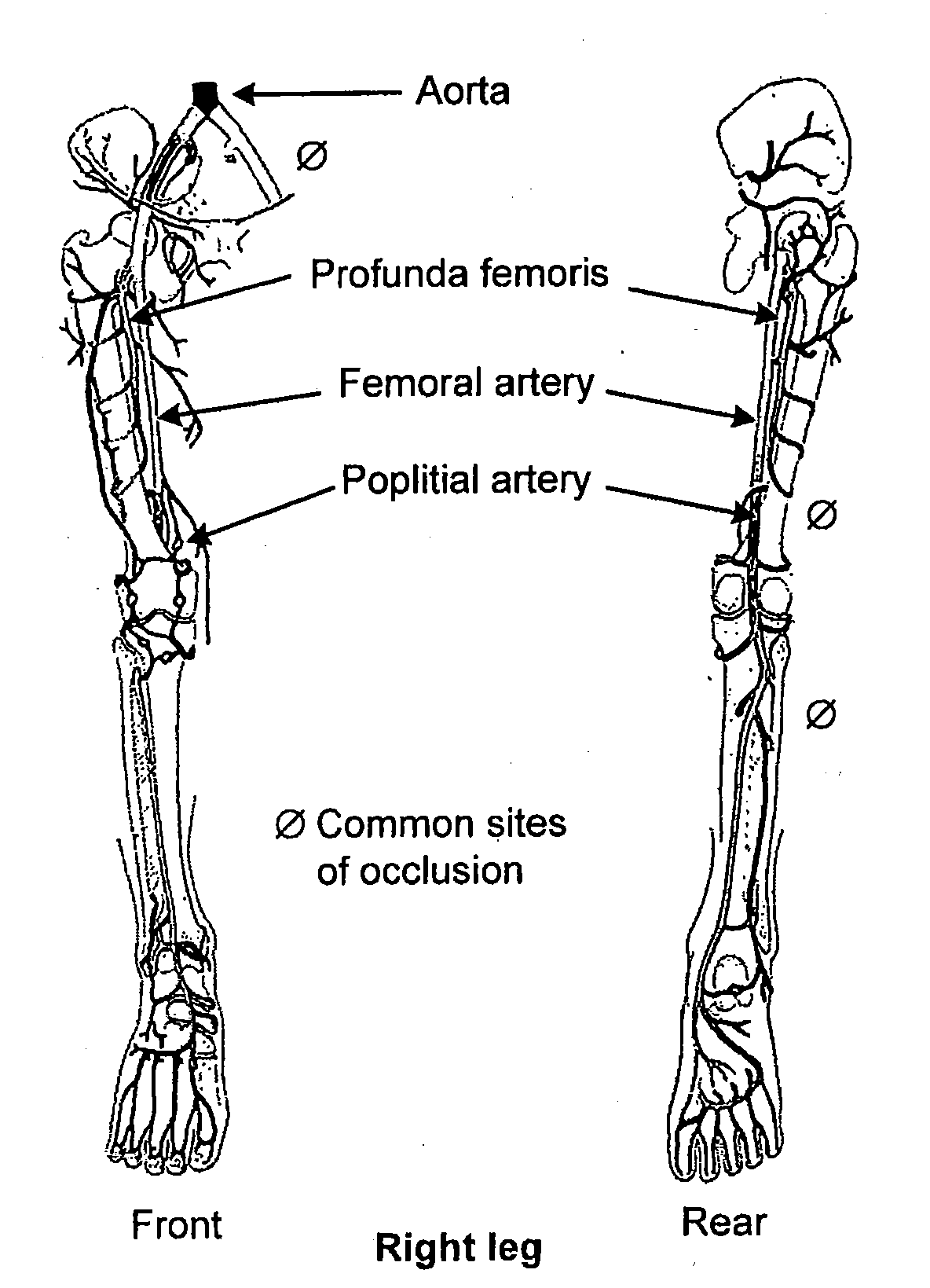 Formulations and methods for treatment of inflammatory diseases