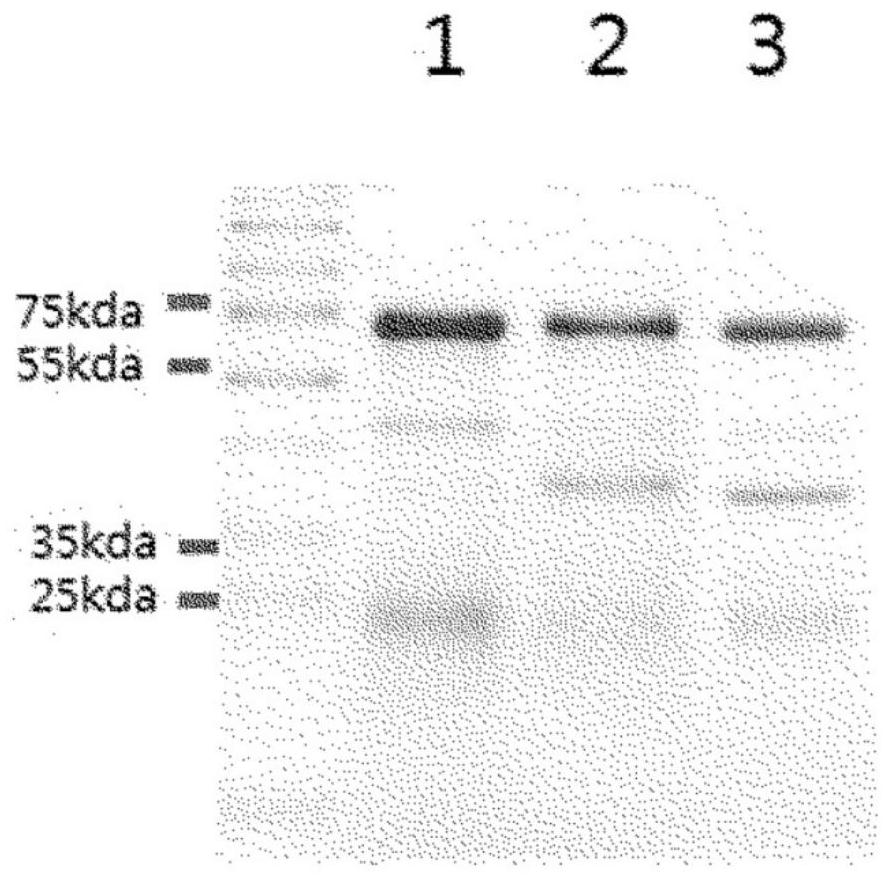Method for producing yolk antibody for prevention or treatment of obesity through cholesterol absorption inhibition